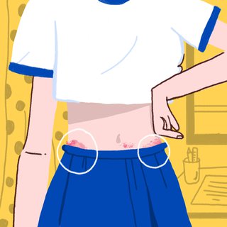Yang Terjadi di Kulitmu Sebelum Menstruasi