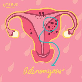 Ada yang Nggak Beres dengan Tubuhku Saat Menstruasi