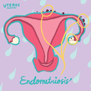 Ada yang Nggak Beres dengan Tubuhku Saat Menstruasi